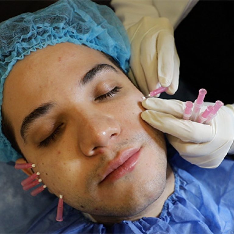 HILOS MONOFILAMENTO 1_v2.1